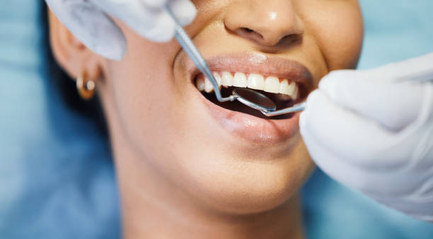 Best Emergency Dental Care for Broken or Chipped Teeth in Hesston, KS