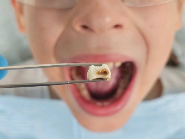 Best Cosmetic Emergency Dentistry in Hesston, KS